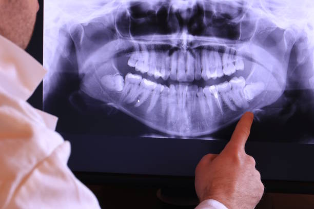 Best Weekend Emergency Dentist in Granby, MO