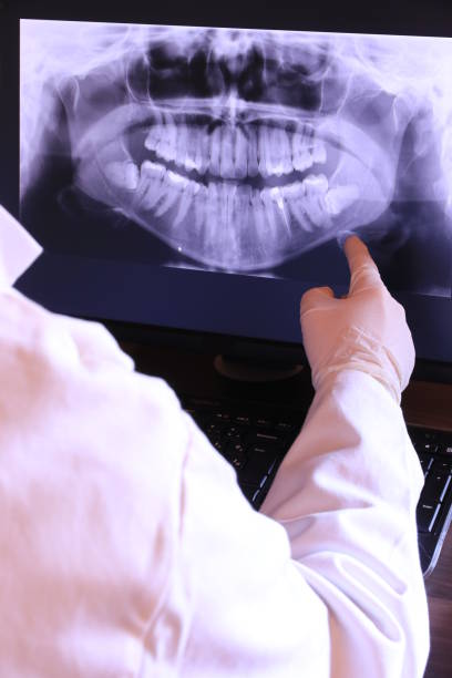 Best Emergency Tooth Extraction in Granby, MO